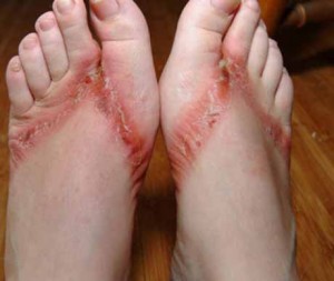 piedi