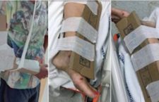Reggio Calabria, Sanità: manca il gesso, pazienti medicati con pezzi di cartone al pronto soccorso [Photo]